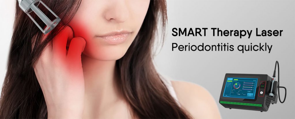 Periodontitis quickly