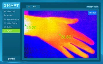 thermal imaging function