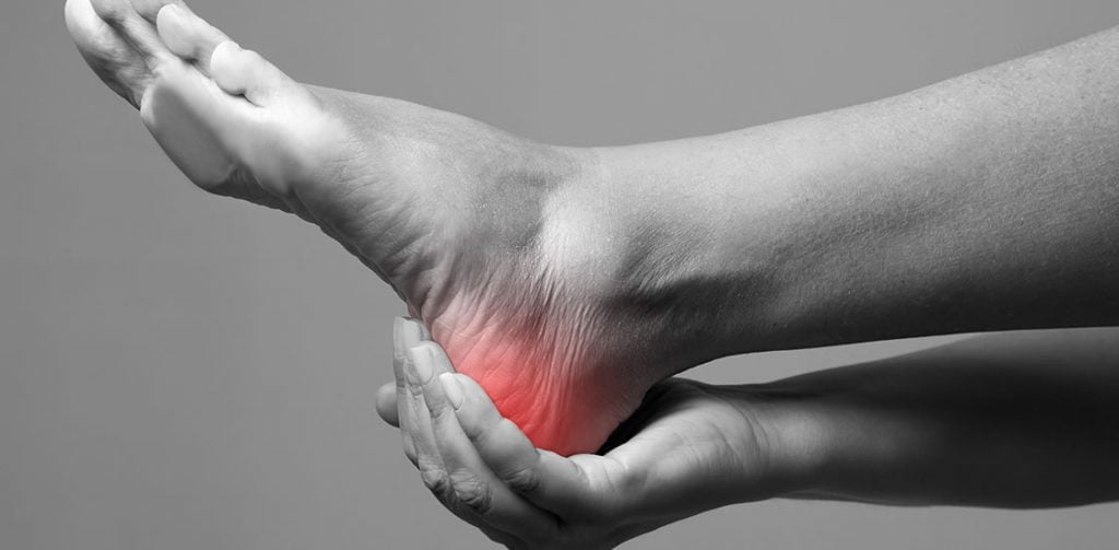 Plantar fasciitis