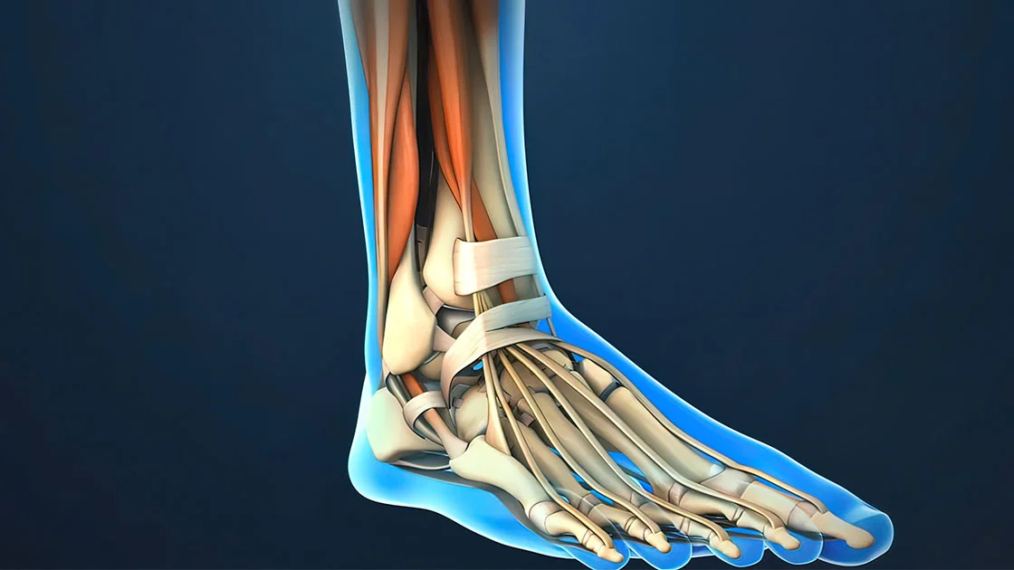 Schnelle Genesung bei Schienbeinkantensyndrom - Lasertherapie steht im Mittelpunkt