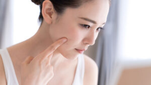 Lasertherapie bei Rosacea Eine vielversprechende Lösung