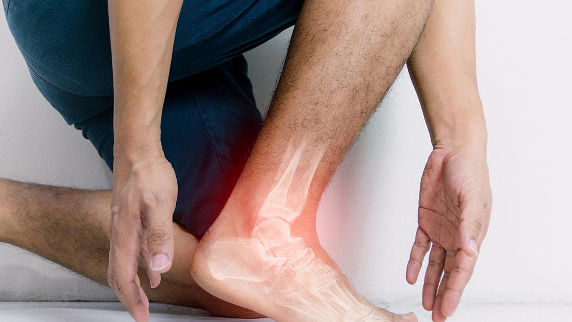 Achilles Tendonitis No Match for Laser Treatment's Healing Beam